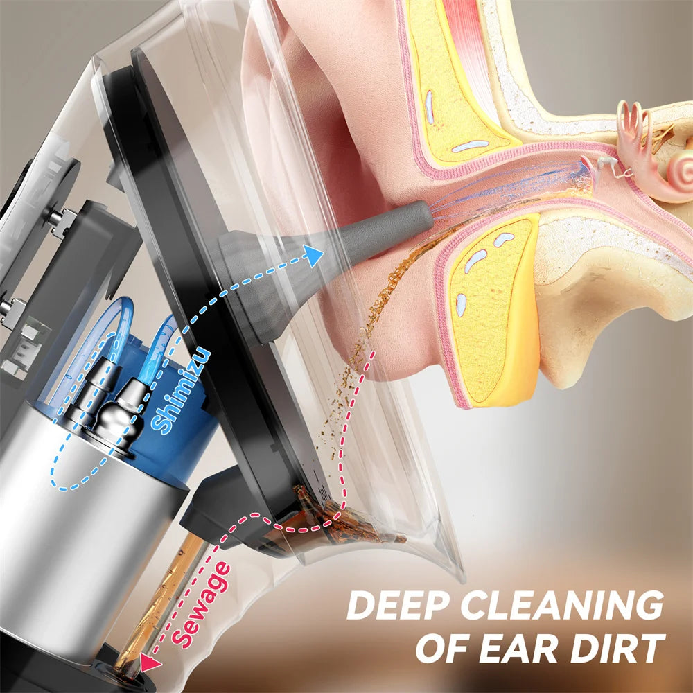 Ear Wax Removal Kit – Safe Water Irrigation with Temperature Sensor