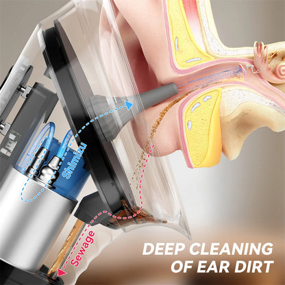 Ear Wax Removal Kit – Safe Water Irrigation with Temperature Sensor